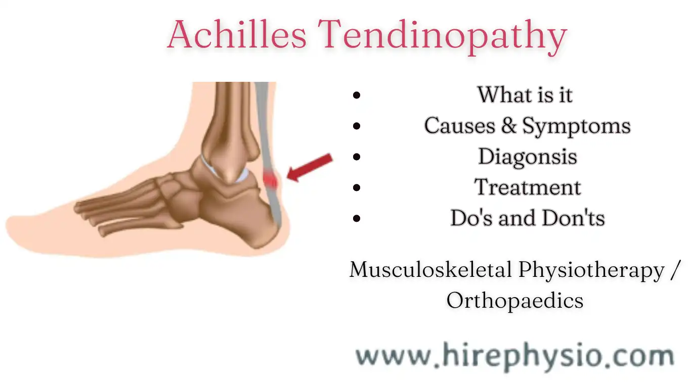 Effective Treatment Options for ACHILLES TENDINITIS (ACHILLES TENDINOPATHY) : Get Quick Relief Now! || Hirephysio.com