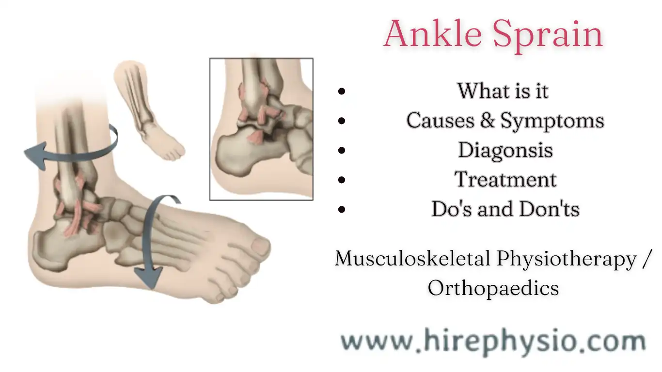 Effective Treatment Options for Ankle Sprains: Get Quick Relief Now! || Hirephysio.com