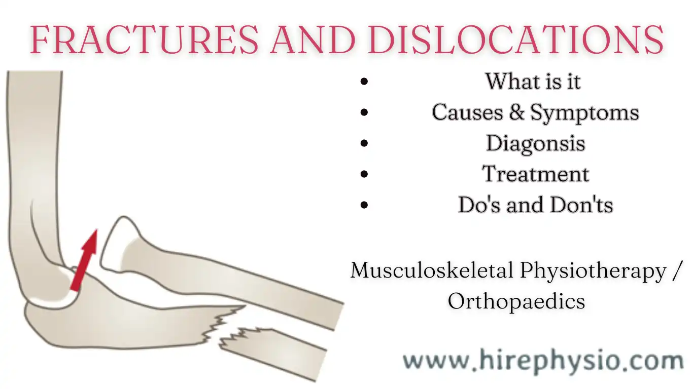 10 Powerful Tips for Quick Recovery from Fractures and Dislocations: Boost Your Healing Process with These Positive Strategies by Physiotherapist || Hirephysio.com