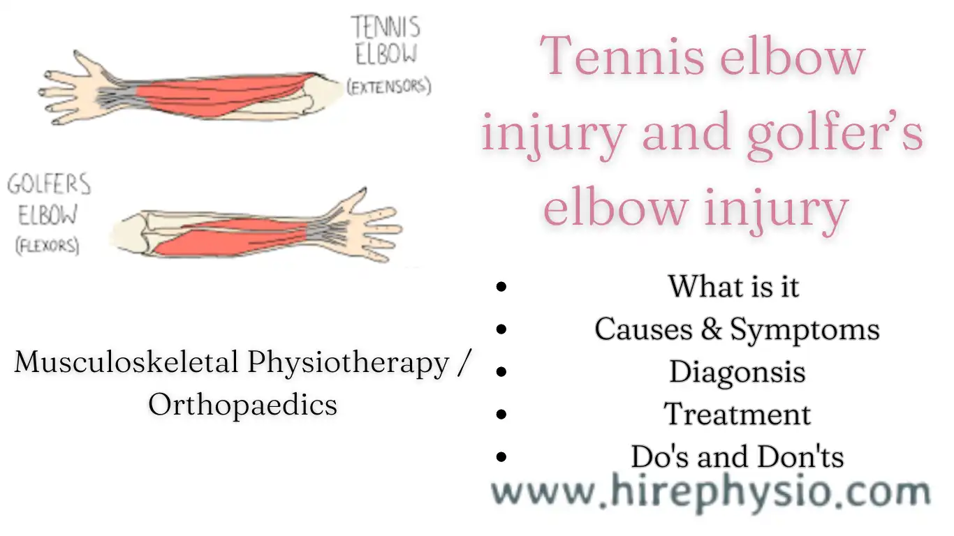 Tennis Elbow and Golfer's Elbow Injuries: Causes, Symptoms, and Treatment | Hirephysio.com