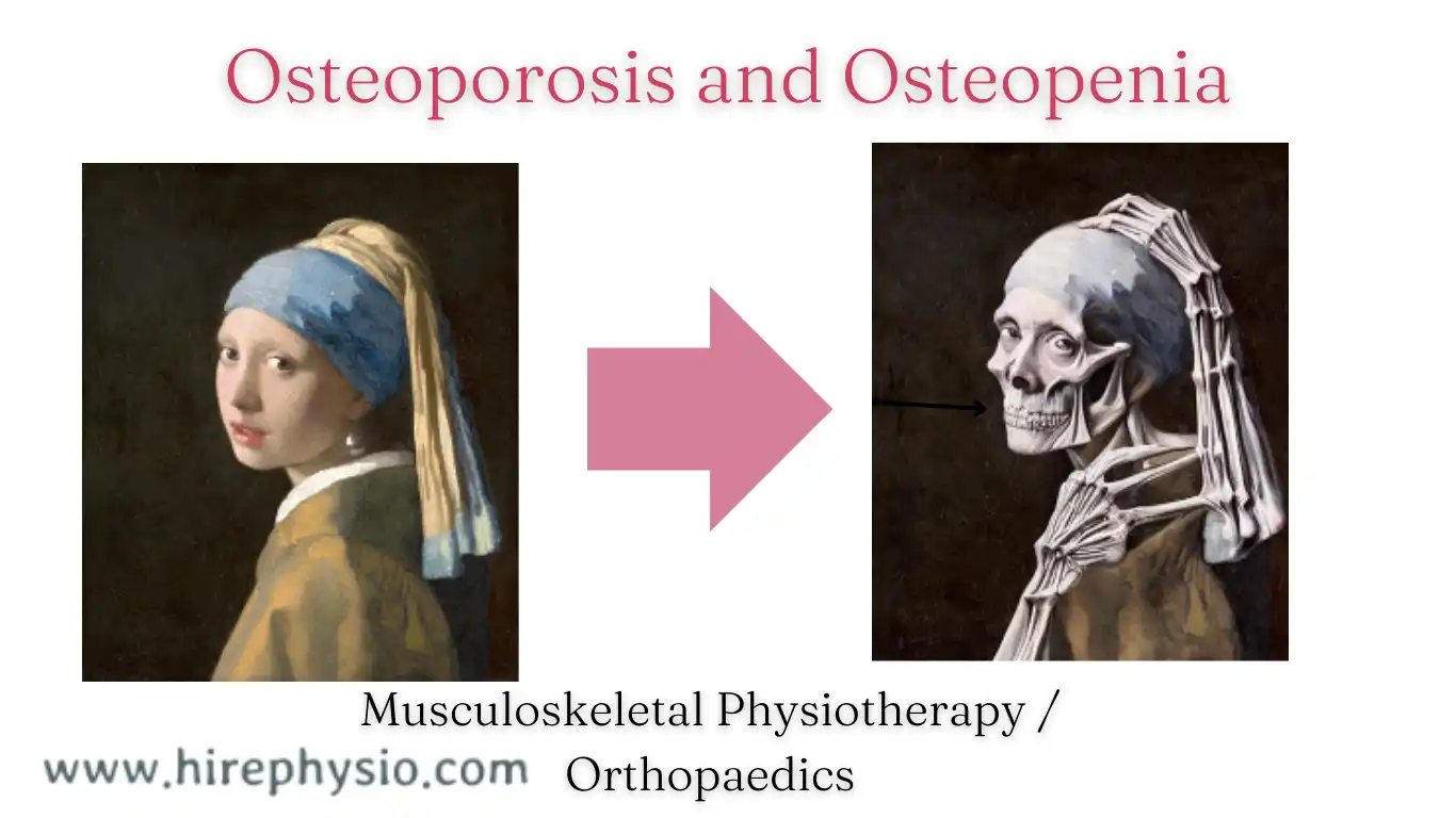 Affordable and effective Treatment of Osteoporosis and Osteopenia